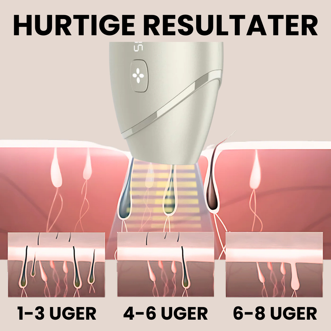 IPL Advanced+ hårfjerner - med HPLE teknologi og hele 17 J/cm² effekt - bedst i test