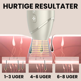 IPL Advanced+ hårfjerner - med HPLE teknologi og hele 17 J/cm² effekt - bedst i test
