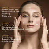 DPL Hudforyngelse “Milk” Light – Skin Rejuvenation Device