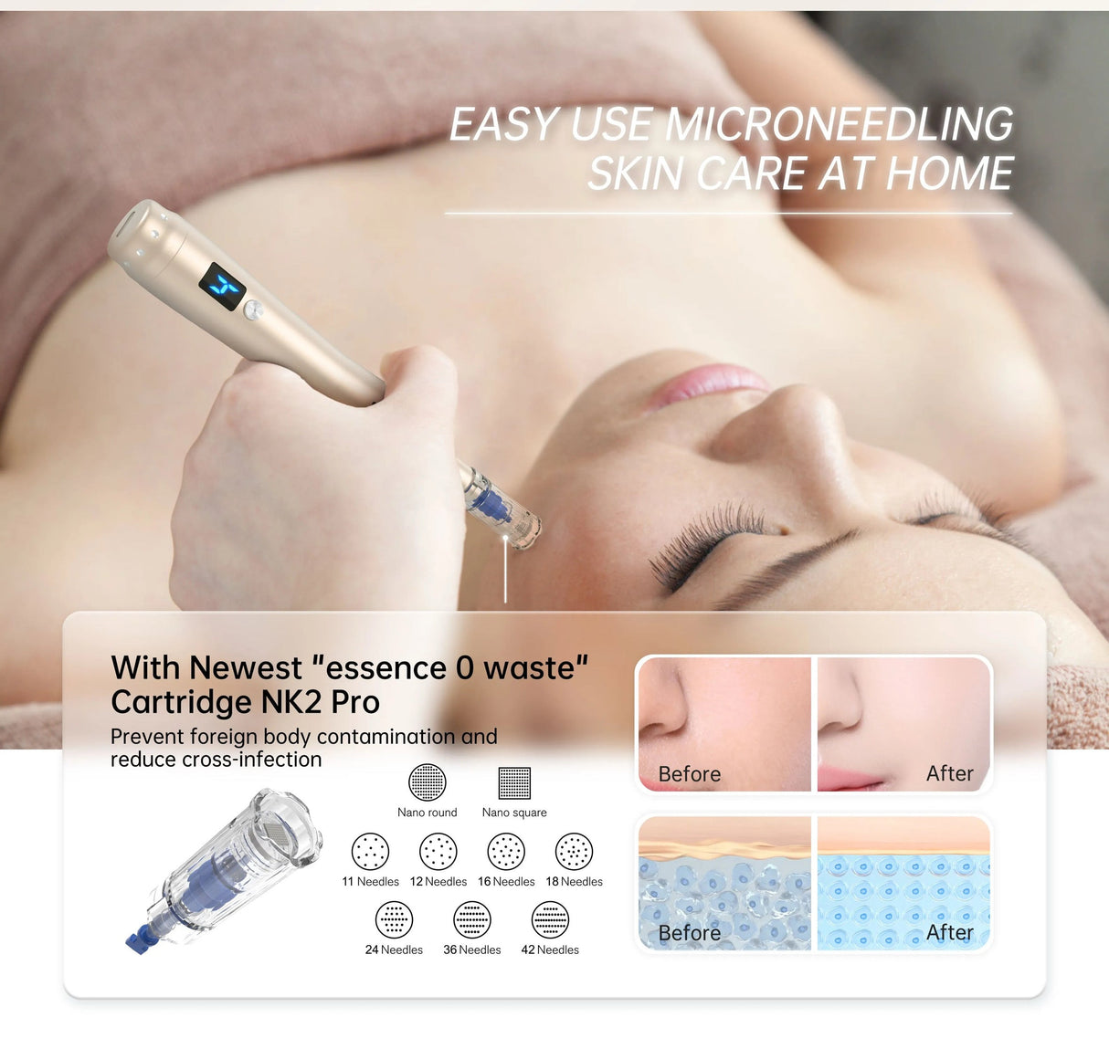 DermaProPen – Professionel Elektrisk MTS Mesotherapy Derma Pen